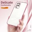 Blue Transparent Plating Case for Realme 8 5G - Fine Hole Design - 5
