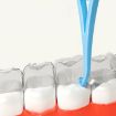 Fawnmum Braces Remover Hook - White - 2