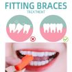 Fawnmum Orthodontic Bite Sticks 2pcs/Box - Original Flavor - 2