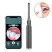 FY-B800 Wireless WiFi HD Oral Endoscope - Visual Observation - 1