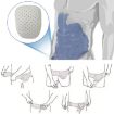 White Adult Groin Hernia Protection Belt - 6