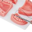 Silicone Suture Practice Mold for Oral Surgery Training, Four Teeth - 3