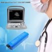 Battery for Chison ECO 5/6 Portable Ultrasound (p/n 33-00012-00) - 4