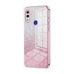 Xiaomi Redmi Note 7/Pro Pink Gradient Glitter Electroplated Case - 1