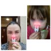 BIONASE Nose Care Therapy Machine for Rhinitis & Sinusitis Treatment - 2
