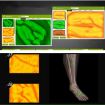 Vascular Vein Display Inspection Camera P2-1 - Medical Imaging Device - 6