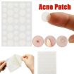 Acne Tool Set - 3 PCS Treatment for Scars & Pimples Stickers - 6