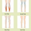 Calf Air Wave Leg Massager for Varicose Veins - Ordinary Type - 5