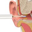 Bebird T15 Smart Visible Luminous Ear Pick Set - Dawn White - 6