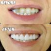 Instant Smile Comfort Fit Flex False Teeth Cover - Beauty Tool 70 Char - 4