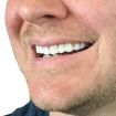 Instant Smile Comfort Fit Flex False Teeth Cover - Beauty Tool 70 Char - 5