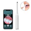 Wireless WiFi HD Oral Endoscope FY-B800 Visual Observation (White) - 1