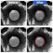 Tesla Model 3/Y Carbon Fiber Wheel Hub Decoration Ring Set - 4pcs, Black - 6